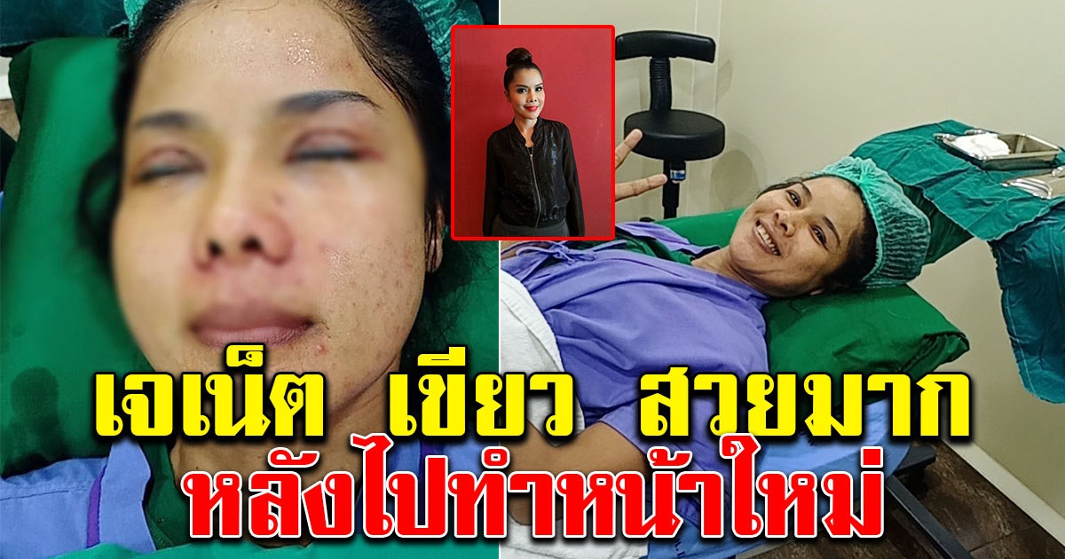 เจเน็ต เขียว สวยขึ้นมาก