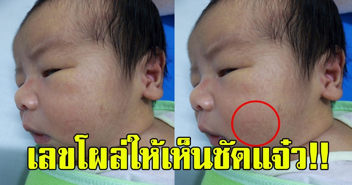 หนุ่มโพสต์ บุตรพึ่งเกิด เห็นเลขโผล่ให้เห็นชัดแจ๋ว