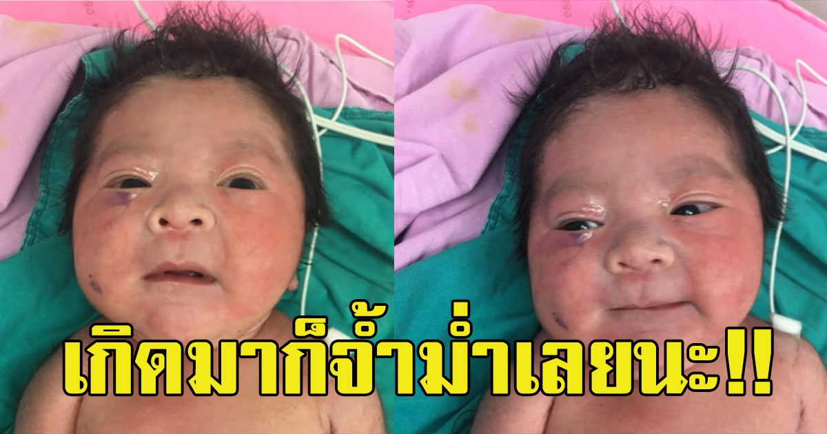 สาวโพสต์ภาพ หนูน้อย